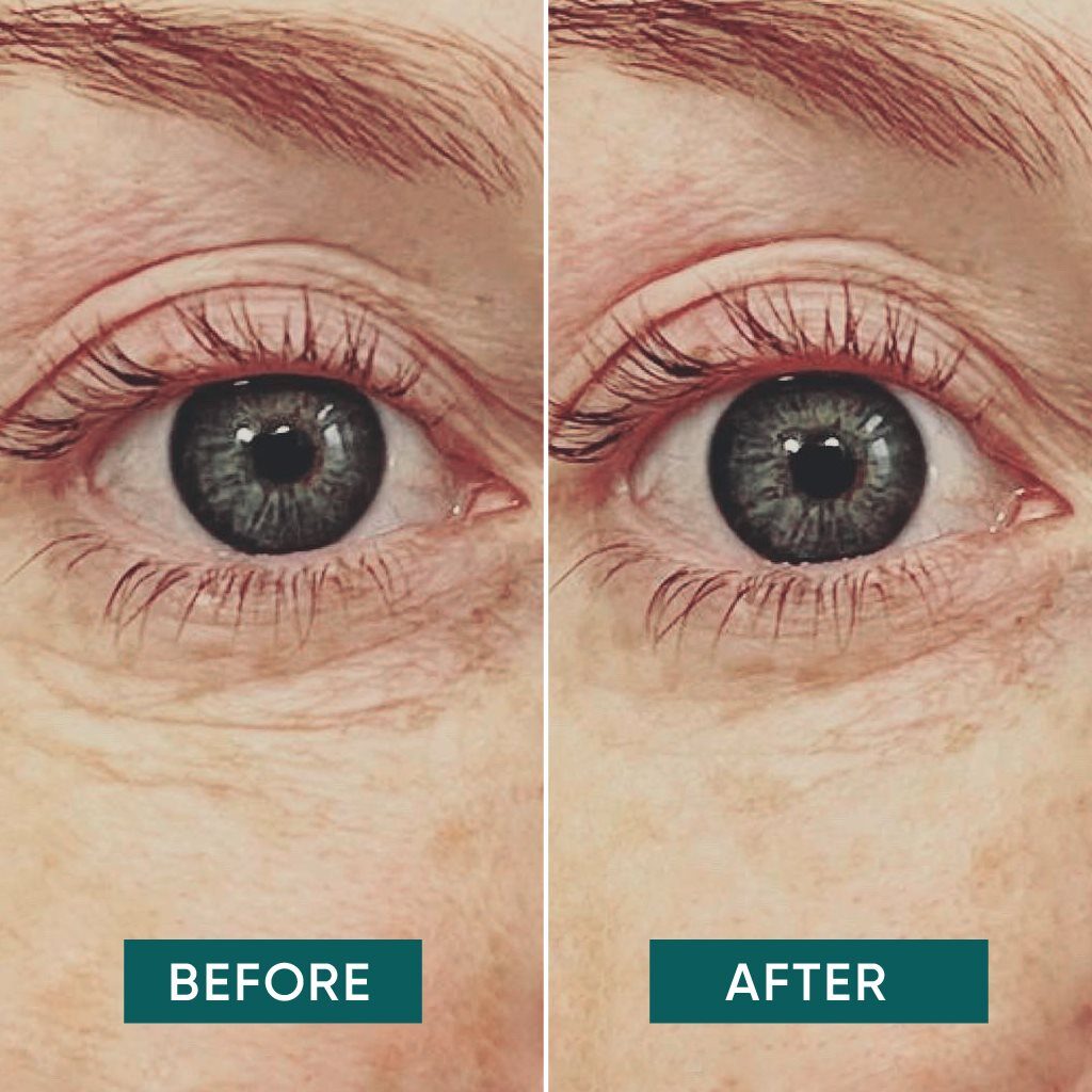 APRICOT pad yeux réutil hyaluron 2 pce