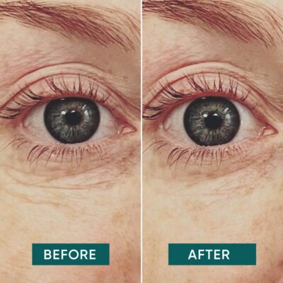 APRICOT pad yeux réutil hyaluron 2 pce