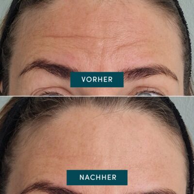 APRICOT pad front réutil glow booster